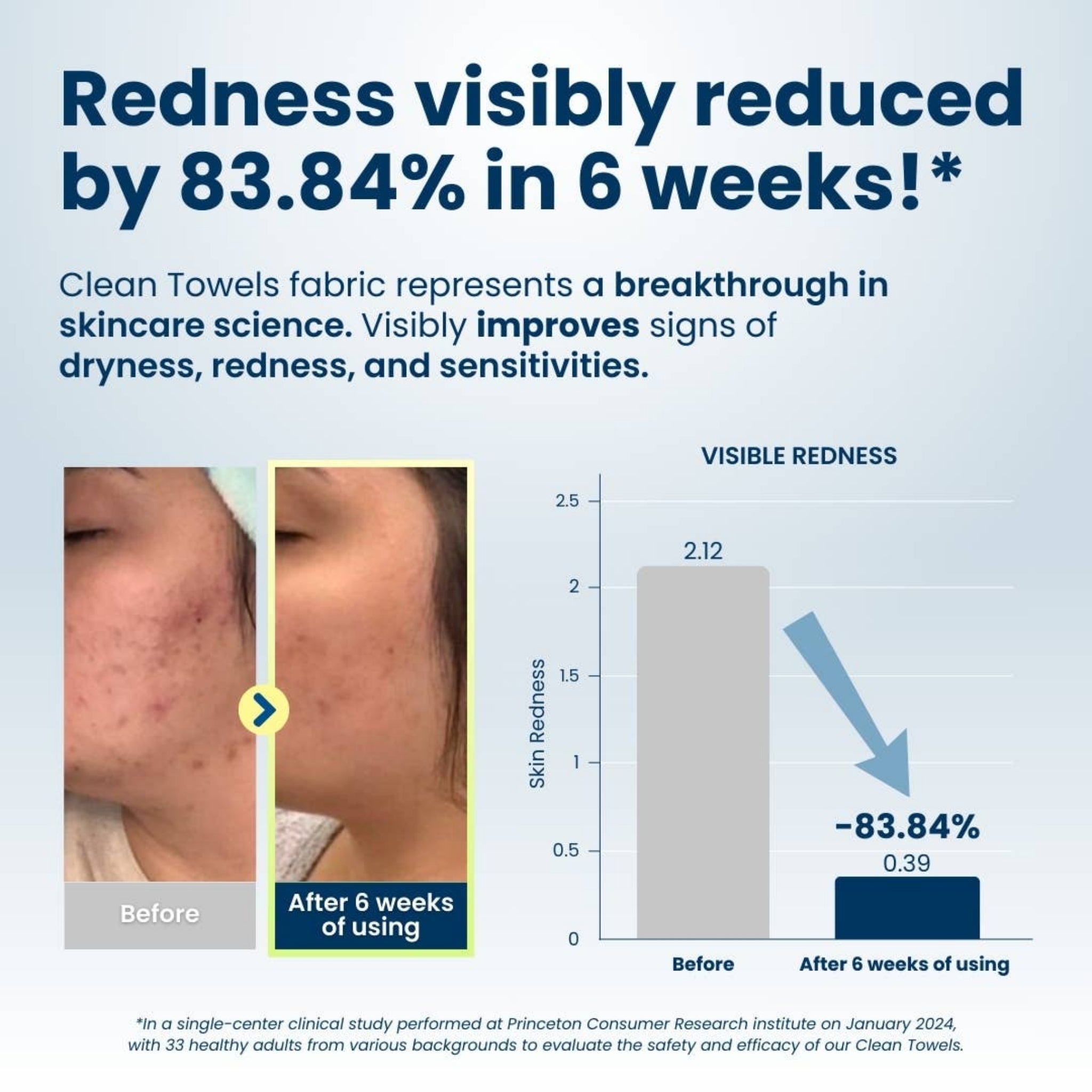 Disposable face towel with redness reduction result graphic for skincare comfort.